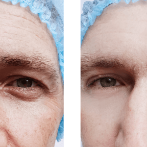 Schönheitspraxis Dr. Dado - Fraxel Dual Laser Zentrum