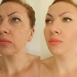 Schönheitspraxis Dr. Dado - Fraxel Dual Laser Zentrum