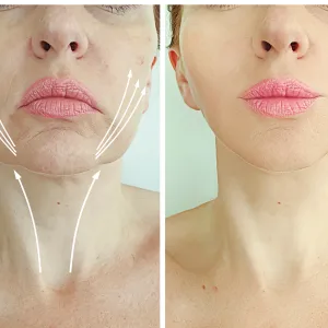 Schönheitspraxis Dr. Dado - Fraxel Dual Laser Zentrum