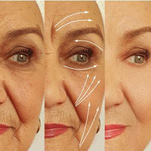 Schönheitspraxis Dr. Dado - Fraxel Dual Laser Zentrum