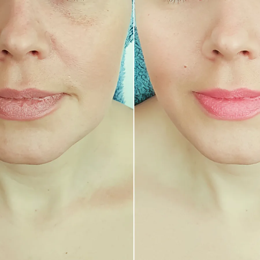 Schönheitspraxis Dr. Dado - Fraxel Dual Laser Zentrum