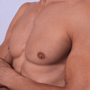 Schönheitspraxis Dr. Dado - Fraxel Dual Laser Zentrum